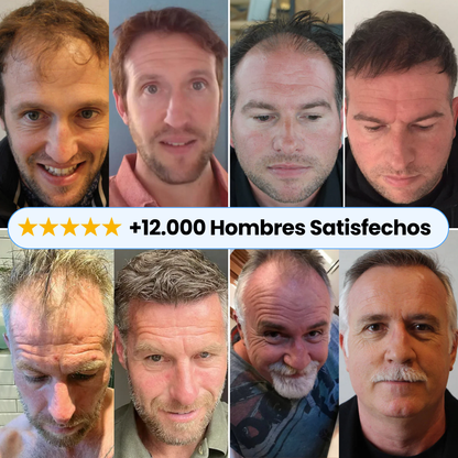 Sculpix™ | Serum Nº1 Para el Crecimiento Capilar