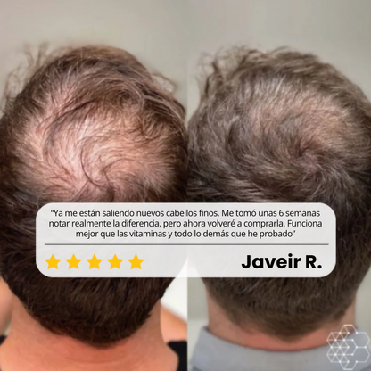 Sculpix™ | Serum Nº1 Para el Crecimiento Capilar